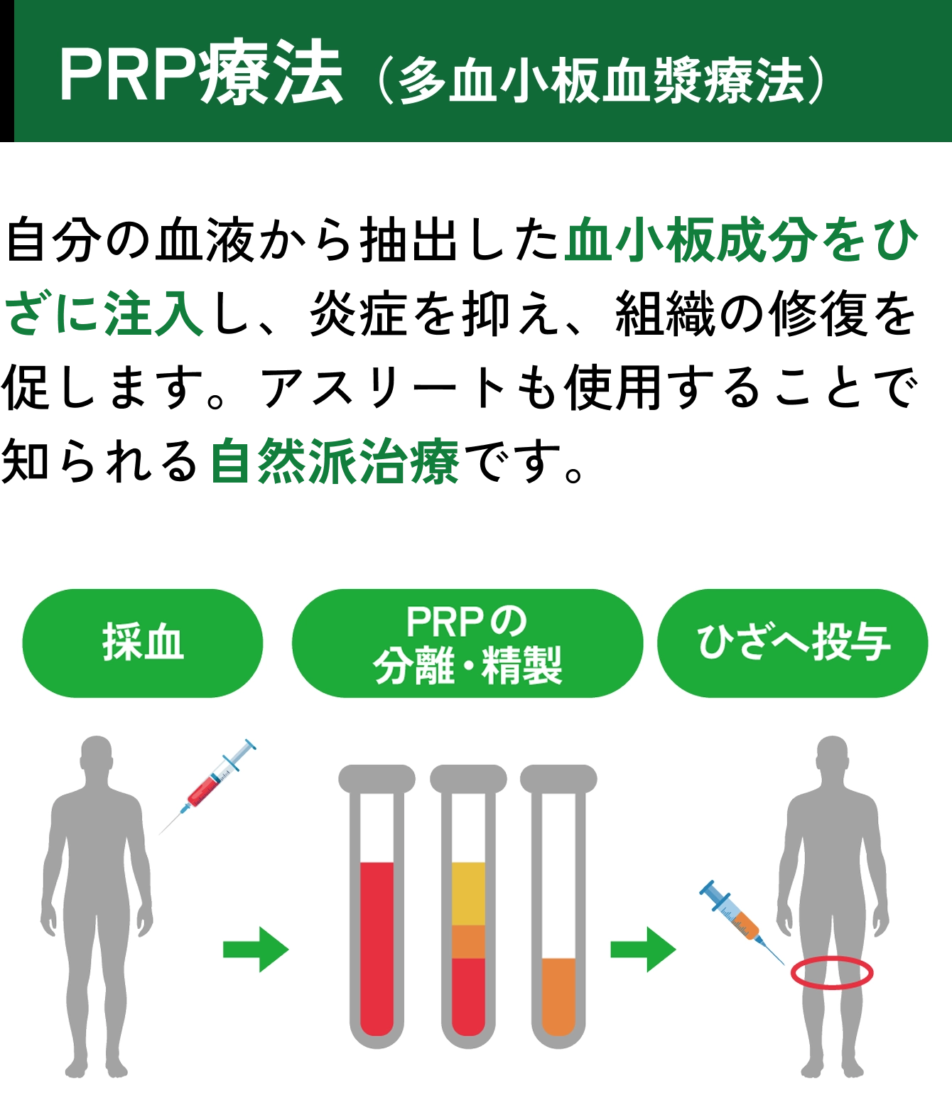 PRP療法（多血小板血漿療法）