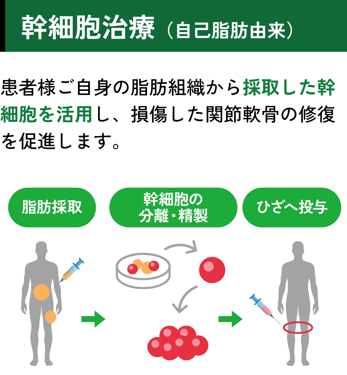 幹細胞治療（自己脂肪由来）