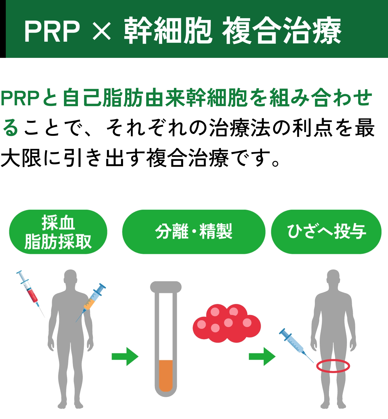 PRP × 幹細胞 複合治療